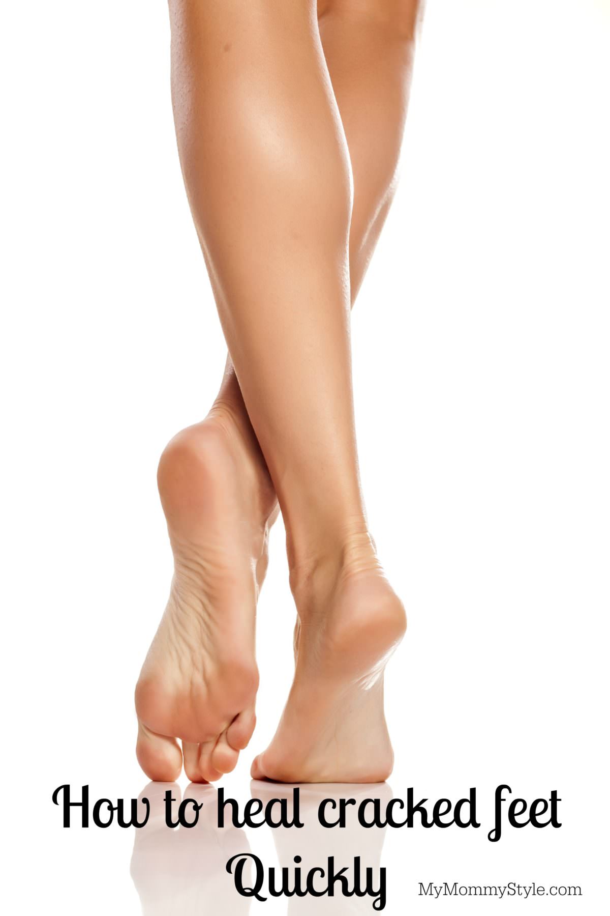 Can Exercise Make Cracked Heels Worse? – Delfina Skin™